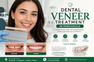 Dental Veneer Treatment in Panchkula