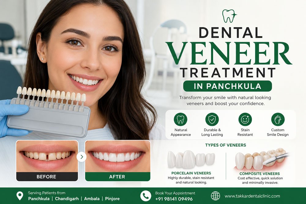 Dental Veneer Treatment in Panchkula
