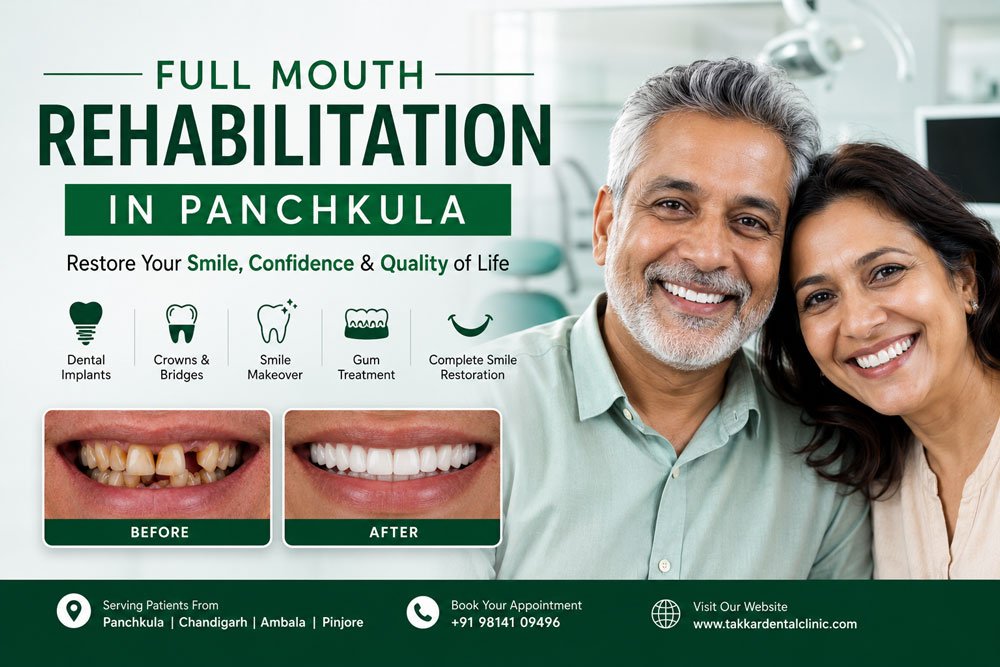 Full Mouth Rehabilitation in Panchkula